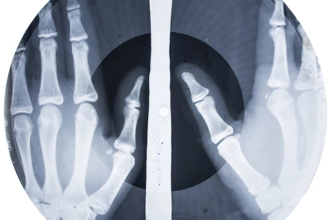 Zakazane piosenki na zdjęciach rentgenowskich